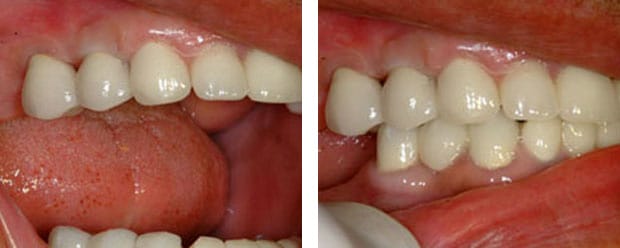 Implants P 7 Continued